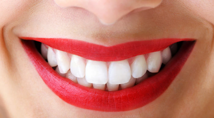 Resultado de imagen de estetica dental