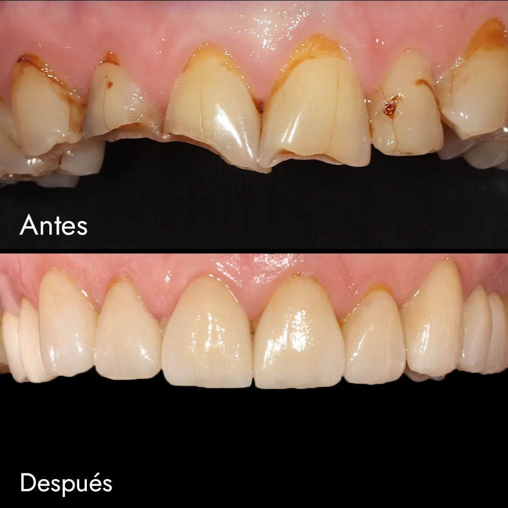 Rehabilitación Oral