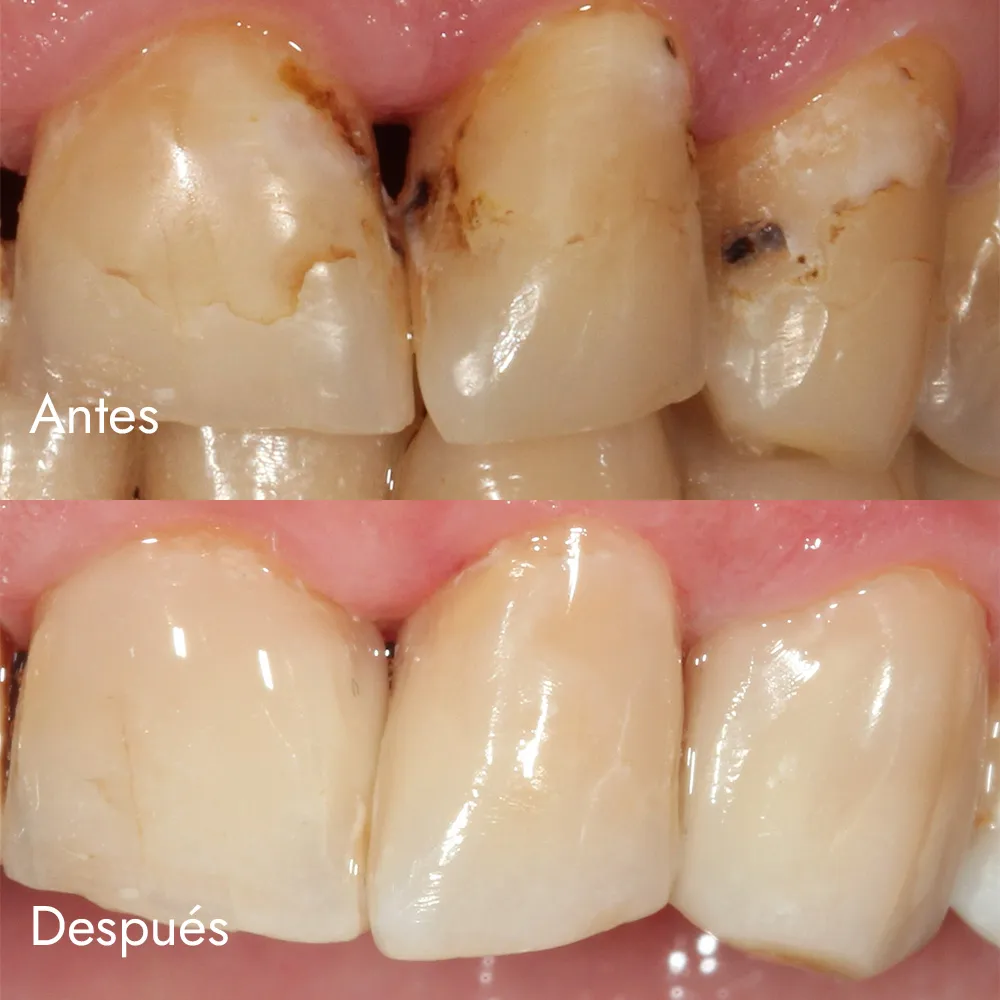 Reconstrucción estética