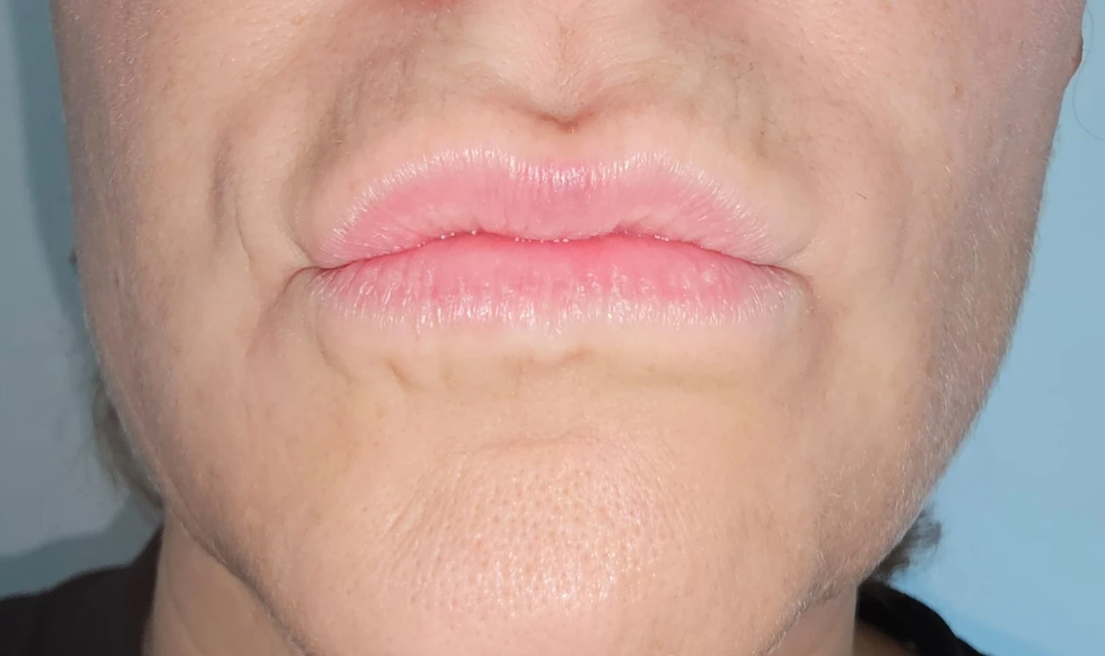 Código de Barras y Surcos Labiales