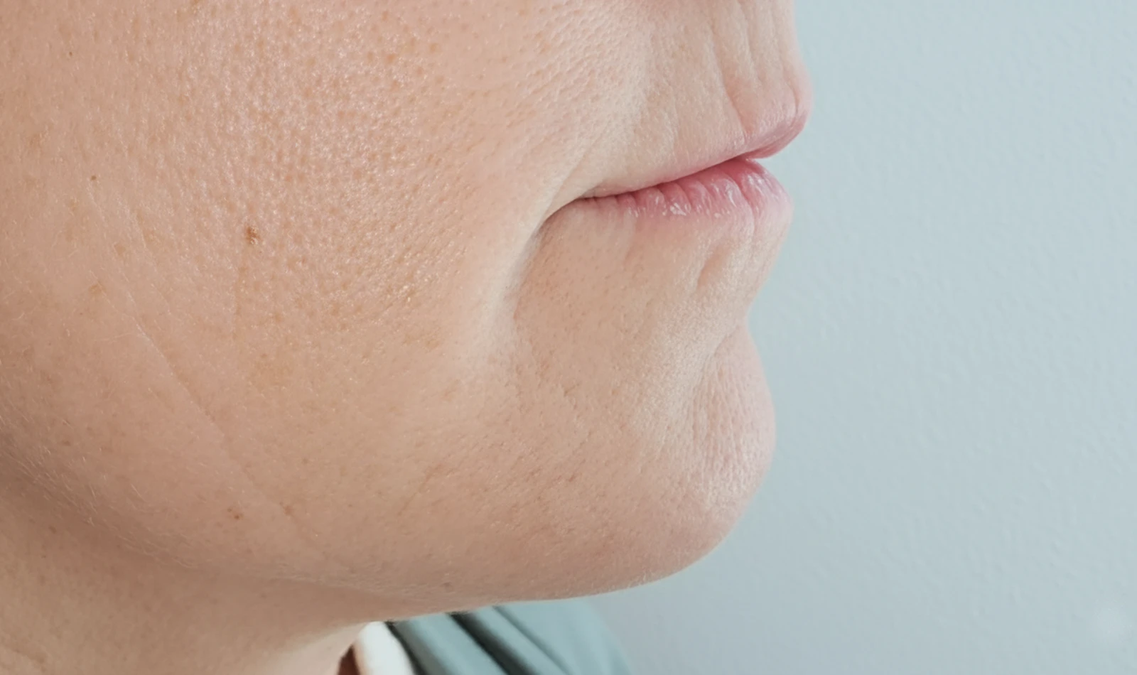 Código de Barras y Surcos Labiales