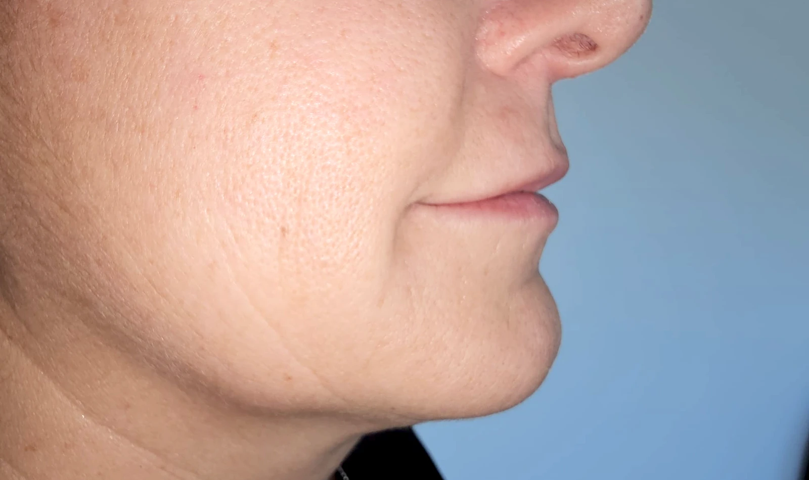 Código de Barras y Surcos Labiales