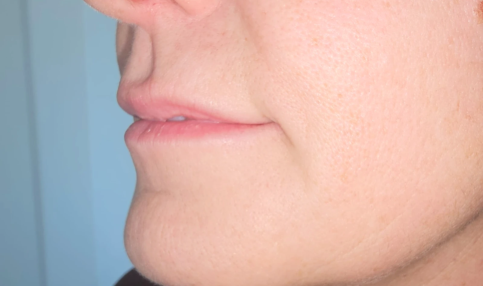 Código de Barras y Surcos Labiales