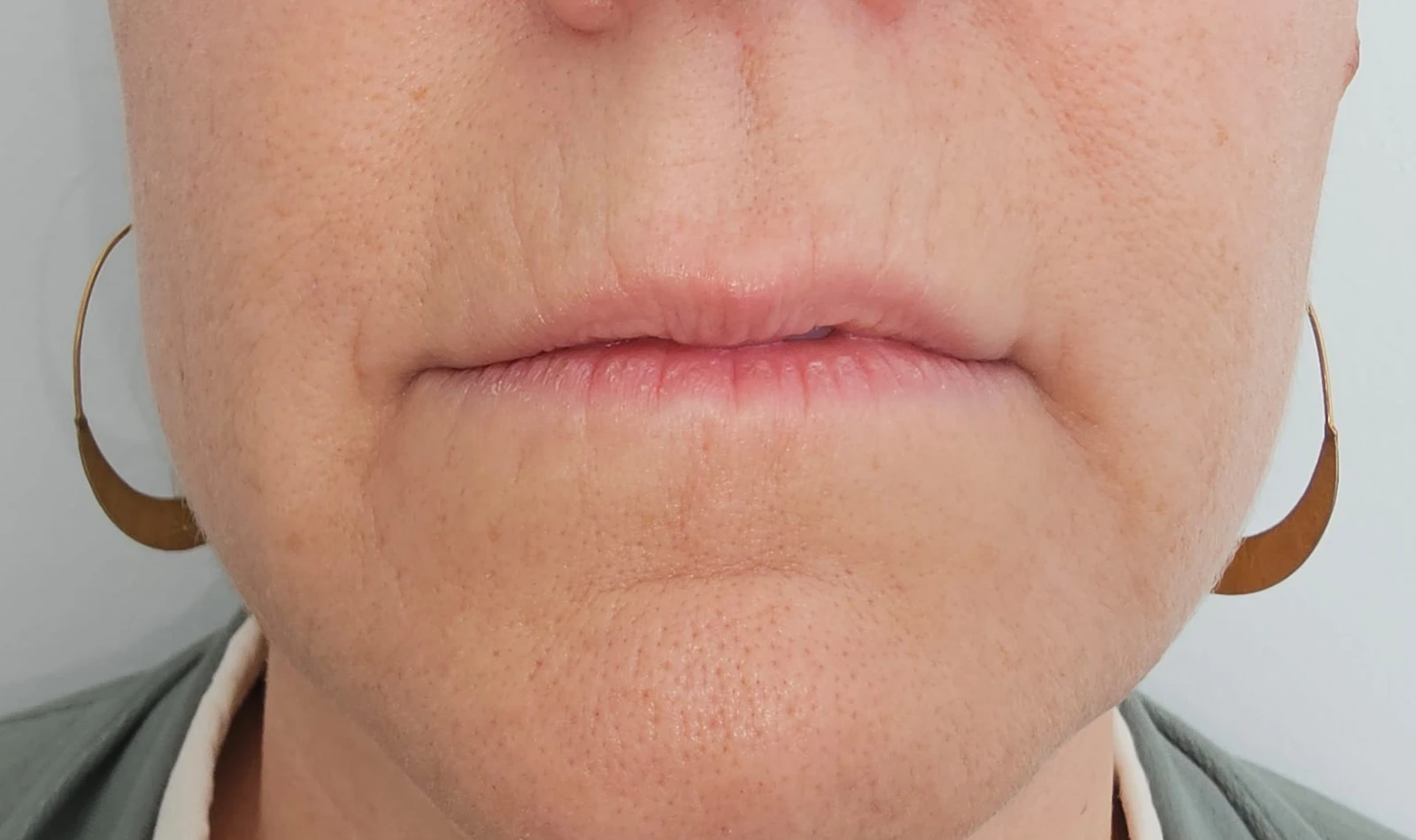 Código de Barras y Surcos Labiales