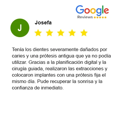 Carga inmediata alzamora dental