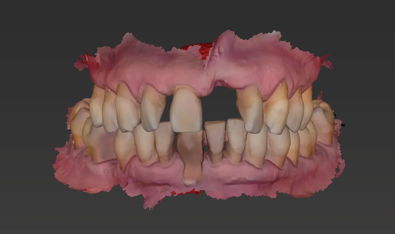 cirugia guiada alzamora