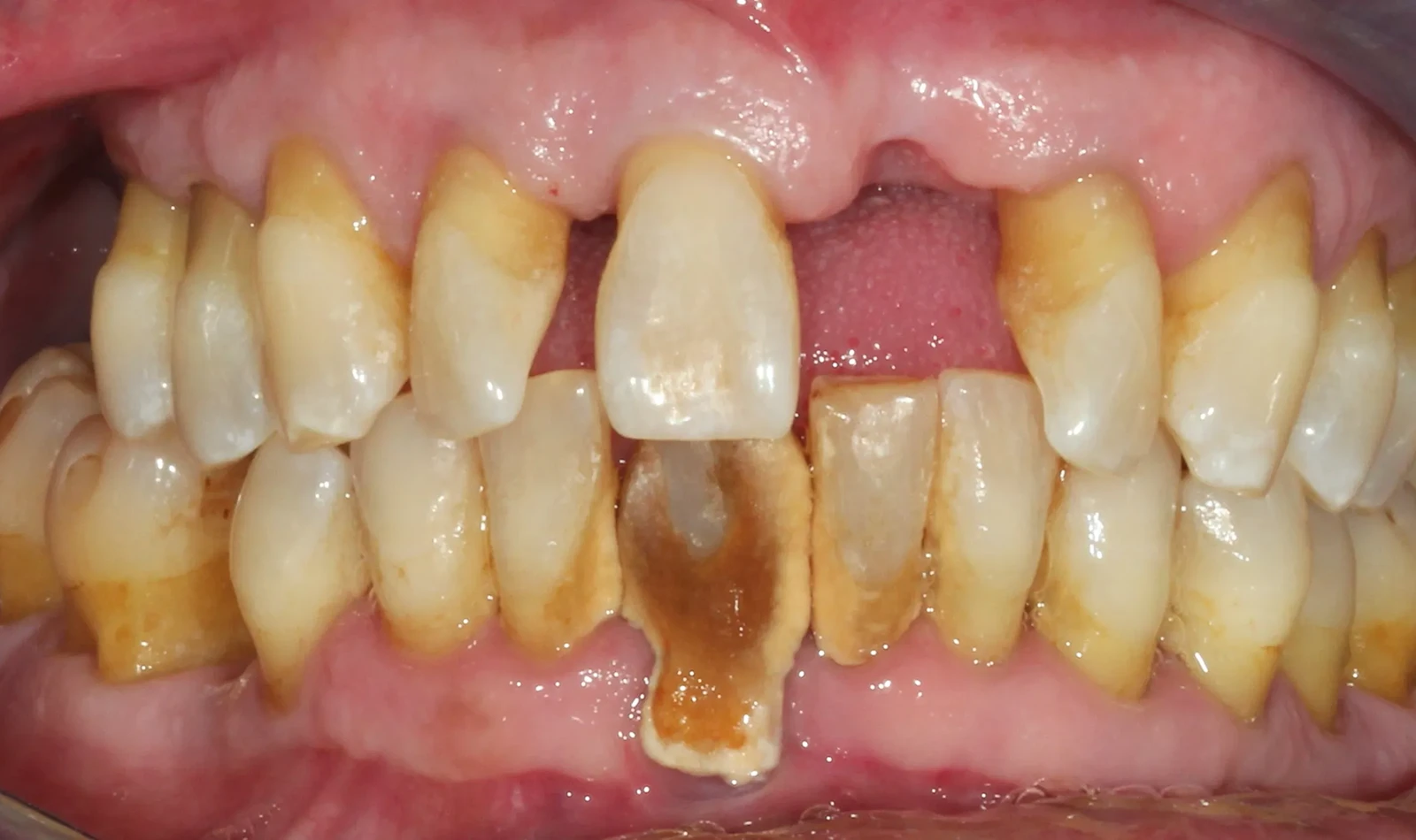 cirugia guiada alzamora