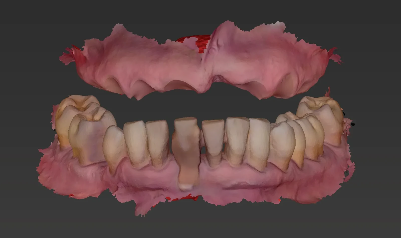 cirugia guiada alzamora
