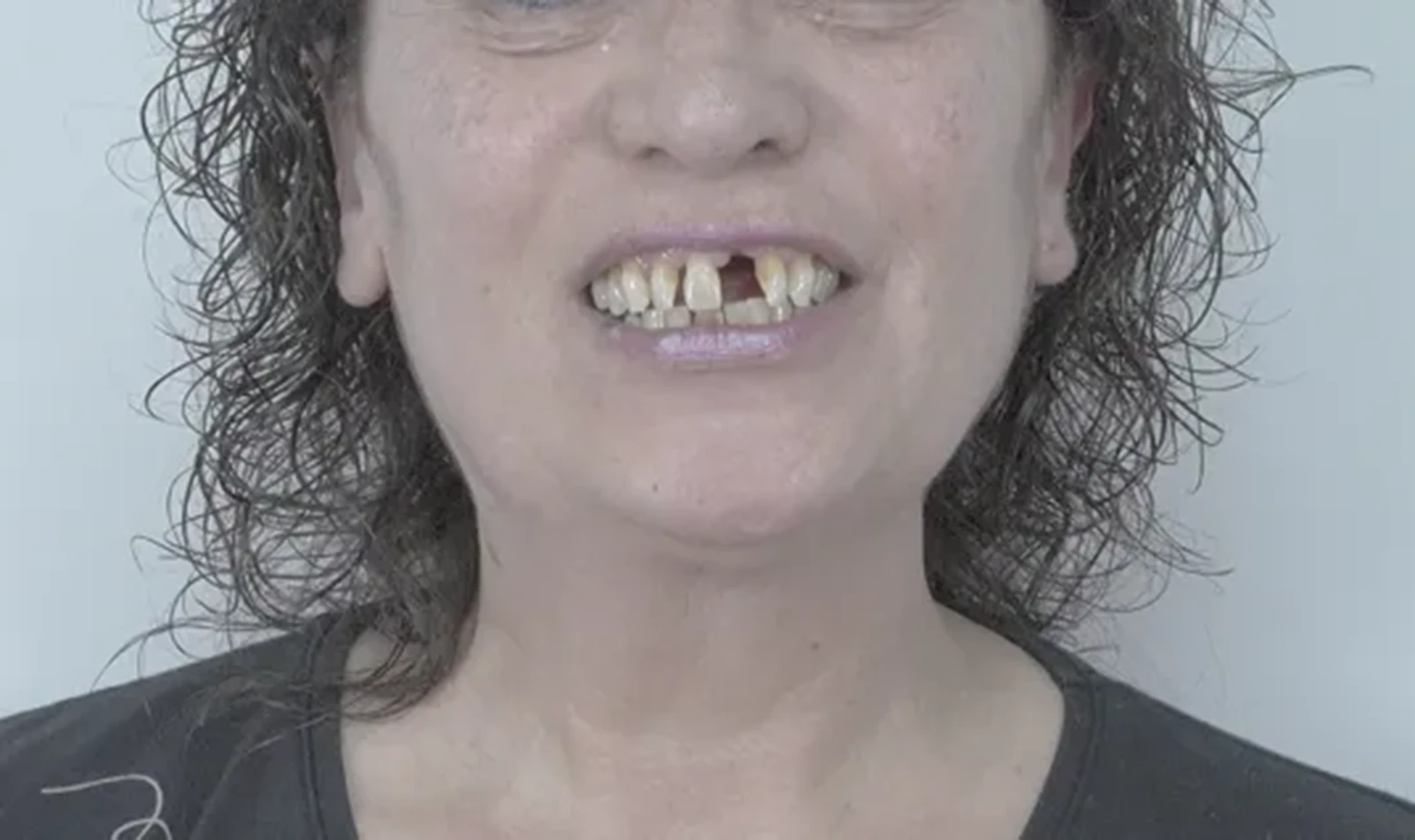 cirugia guiada alzamora