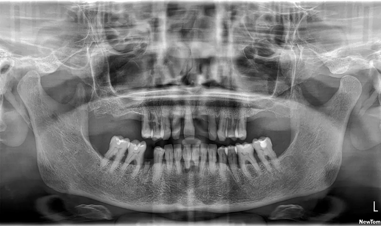 cirugia guiada alzamora