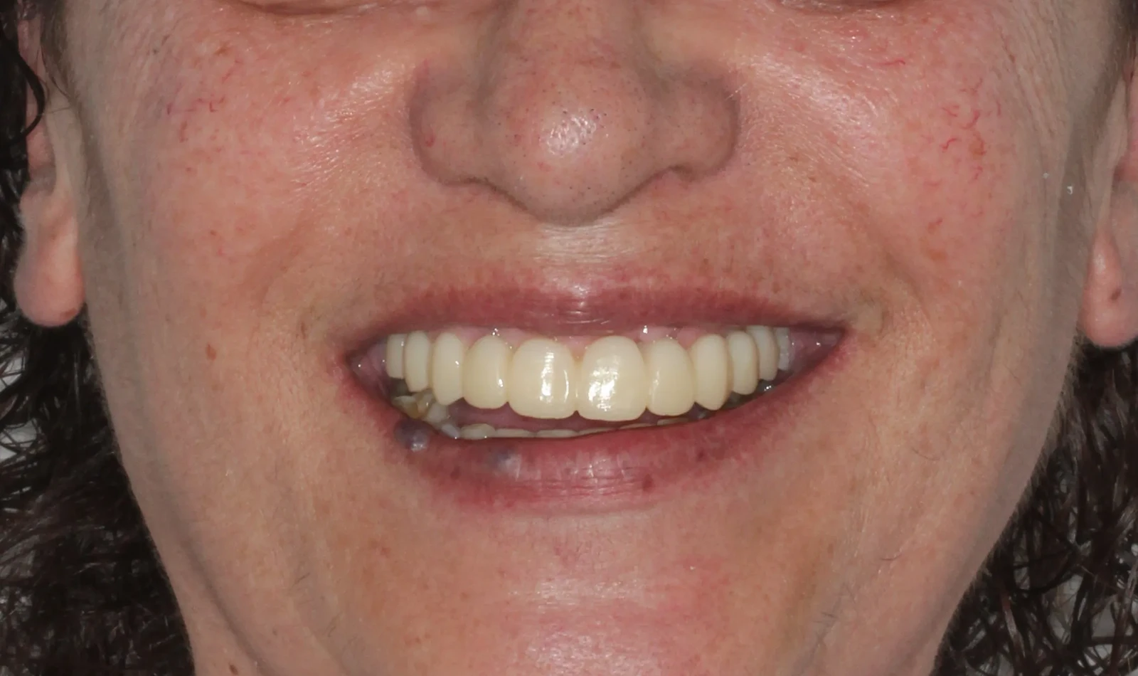 cirugia guiada alzamora