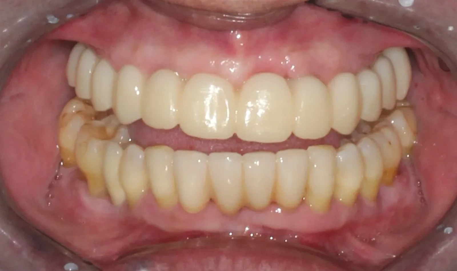 cirugia guiada alzamora