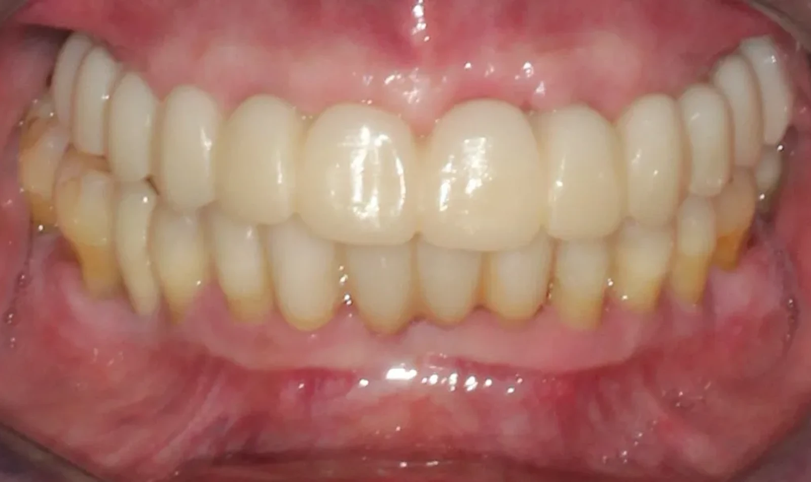 cirugia guiada alzamora