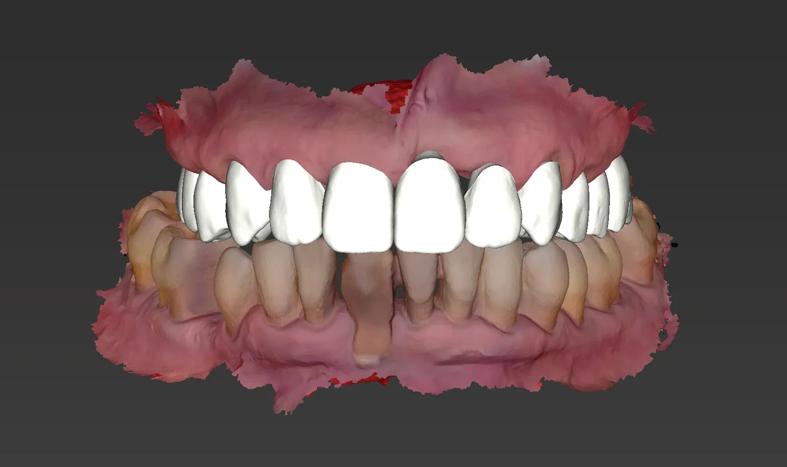 cirugia guiada alzamora